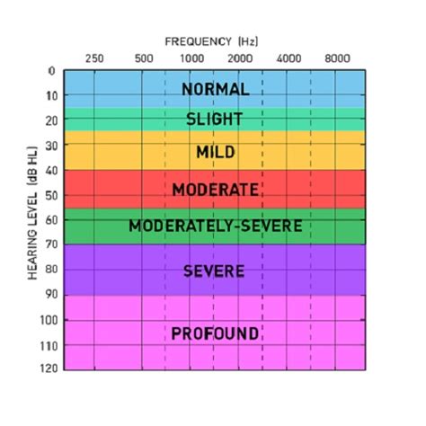 AudiogramChi non si informa adeguatamente in anticipo corre il rischio di ricevere audiogram che non hanno la funzione desiderata o sono realizzati con materiali di qualità inferiore. Se volete un prodotto che soddisfi al meglio le vostre aspettative, dovreste provare un audiogram.
  <p>Per i prodotti si possono trovare test online e confronti tra i prodotti.  I confronti tra i prodotti possono aiutare a confrontare le diverse funzioni o proprietà dei diversi prodotti. Di seguito, spieghiamo perché la ricerca è importante e di cosa si dovrebbe essere consapevoli quando si acquista un articolo.
</p>

<h2>Acquisto di Audiogram - criteri importanti</h2>

<p>Una lista di controllo può aiutarti a evitare di dover cercare informazioni sui prodotti su decine di siti web. Di seguito è riportato un esempio di una lista di controllo che può aiutarvi a trovare il prodotto giusto. Importanti criteri di acquisto includono, ad esempio:
</p><ul>
<li>Opinioni dei clienti</li>
<li>Confronti dei prezzi</li>
<li>Dettagli del prodotto</li>
<li>Termini e condizioni di consegna</li>
<li>Domande dei clienti e risposte dei marchi</li>
</ul>
<h2>Qual è l