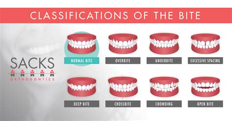 Biting sciChi non si informa adeguatamente in anticipo corre il rischio di ricevere biting sci che non hanno la funzione desiderata o sono realizzati con materiali di qualità inferiore. Se volete un prodotto che soddisfi al meglio le vostre aspettative, dovreste provare un biting sci.
  <p>Per i prodotti si possono trovare test online e confronti tra i prodotti.  I confronti tra i prodotti possono aiutare a confrontare le diverse funzioni o proprietà dei diversi prodotti. Di seguito, spieghiamo perché la ricerca è importante e di cosa si dovrebbe essere consapevoli quando si acquista un articolo.
</p>

<h2>Acquisto di Biting sci - criteri importanti</h2>

<p>Una lista di controllo può aiutarti a evitare di dover cercare informazioni sui prodotti su decine di siti web. Di seguito è riportato un esempio di una lista di controllo che può aiutarvi a trovare il prodotto giusto. Importanti criteri di acquisto includono, ad esempio:
</p><ul>
<li>Opinioni dei clienti</li>
<li>Confronti dei prezzi</li>
<li>Dettagli del prodotto</li>
<li>Termini e condizioni di consegna</li>
<li>Domande dei clienti e risposte dei marchi</li>
</ul>
<h2>Qual è l