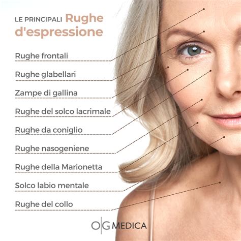 Rughe visoChi non si informa adeguatamente in anticipo corre il rischio di ricevere rughe viso che non hanno la funzione desiderata o sono realizzati con materiali di qualità inferiore. Se volete un prodotto che soddisfi al meglio le vostre aspettative, dovreste provare un rughe viso.
  <p>Per i prodotti si possono trovare test online e confronti tra i prodotti.  I confronti tra i prodotti possono aiutare a confrontare le diverse funzioni o proprietà dei diversi prodotti. Di seguito, spieghiamo perché la ricerca è importante e di cosa si dovrebbe essere consapevoli quando si acquista un articolo.
</p>

<h2>Acquisto di Rughe viso - criteri importanti</h2>

<p>Una lista di controllo può aiutarti a evitare di dover cercare informazioni sui prodotti su decine di siti web. Di seguito è riportato un esempio di una lista di controllo che può aiutarvi a trovare il prodotto giusto. Importanti criteri di acquisto includono, ad esempio:
</p><ul>
<li>Opinioni dei clienti</li>
<li>Confronti dei prezzi</li>
<li>Dettagli del prodotto</li>
<li>Termini e condizioni di consegna</li>
<li>Domande dei clienti e risposte dei marchi</li>
</ul>
<h2>Qual è l